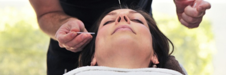 L'acupuncture, comment ça marche ?