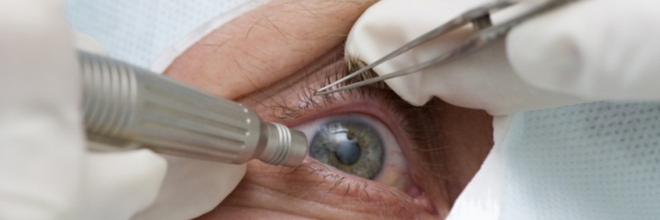 Cataracte : retrouvez la vue !