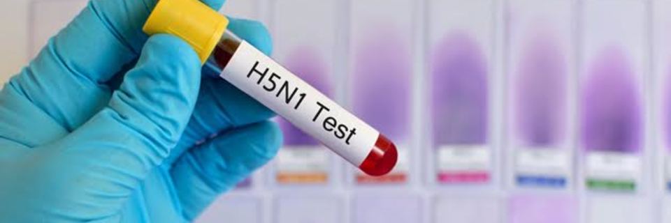 Nouvelle menace de grippe aviaire en France