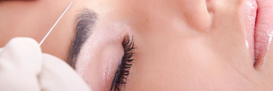 Les différentes méthodes de comblement des rides